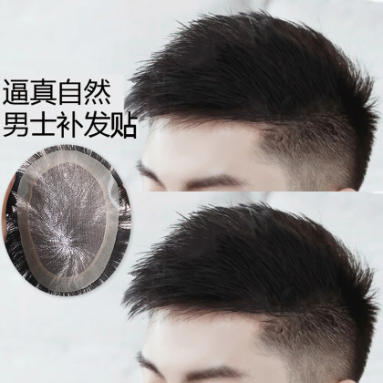 【毛寸款男士补发片】假发男短发隐形轻薄生物头皮秃顶稀少补发片