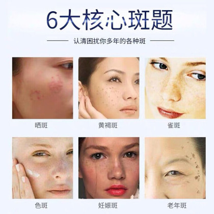 修正祛斑霜30g淡斑祛斑色斑澳莱洁面乳植萃亮肤精华液